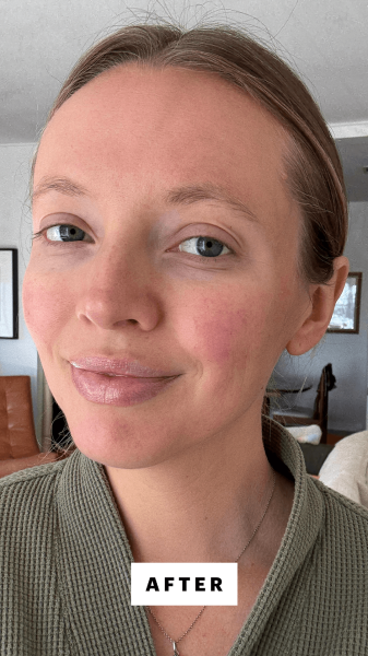 Fowler after applying the Saltyface Tanning Water